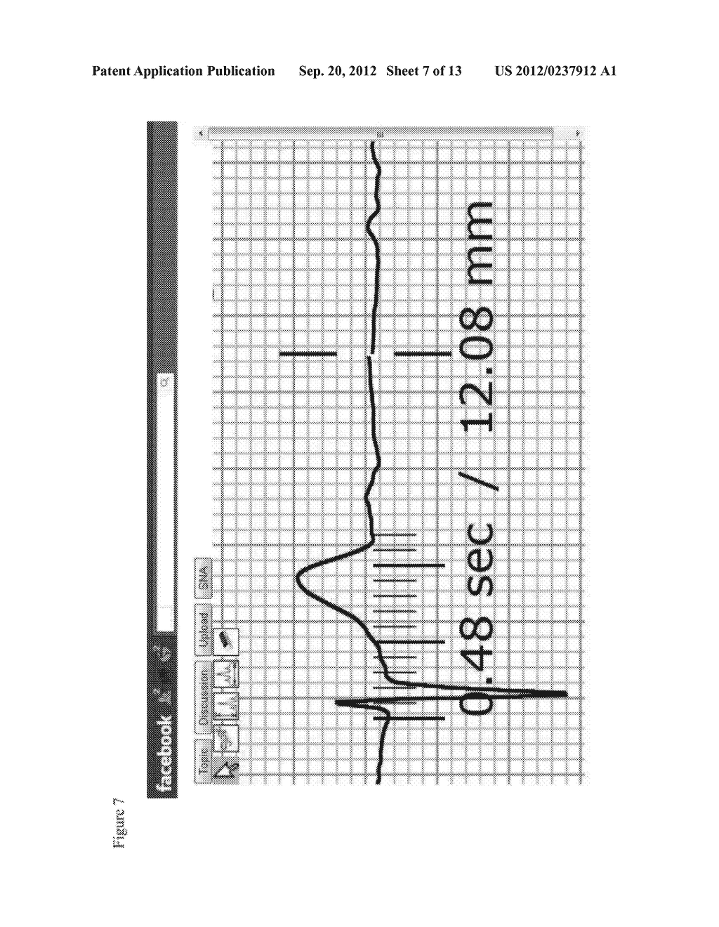 12-LEAD ELECTROCARDIOGRAM ONLINE-LEARNING SYSTEM - diagram, schematic, and image 08