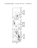 BIOMARKERS FOR PROGNOSES OF PULMONARY DISEASES diagram and image