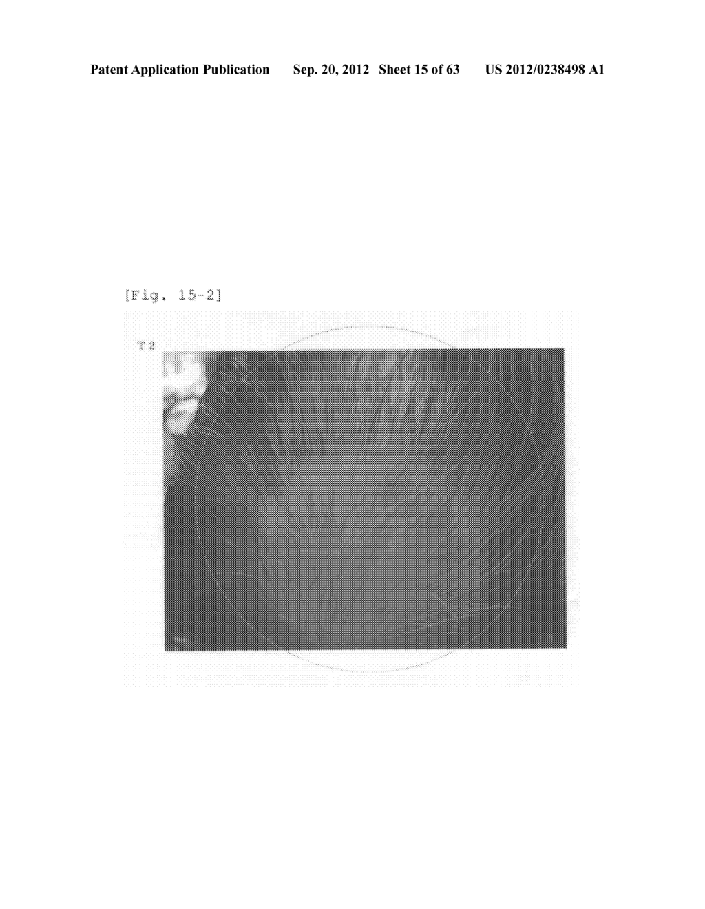 Agent for the treatment of alopecia - diagram, schematic, and image 16