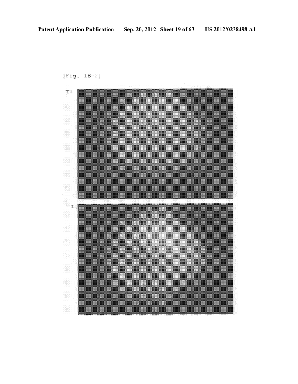 Agent for the treatment of alopecia - diagram, schematic, and image 20