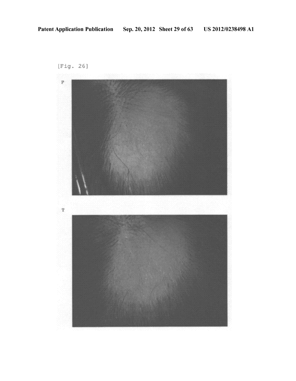 Agent for the treatment of alopecia - diagram, schematic, and image 30