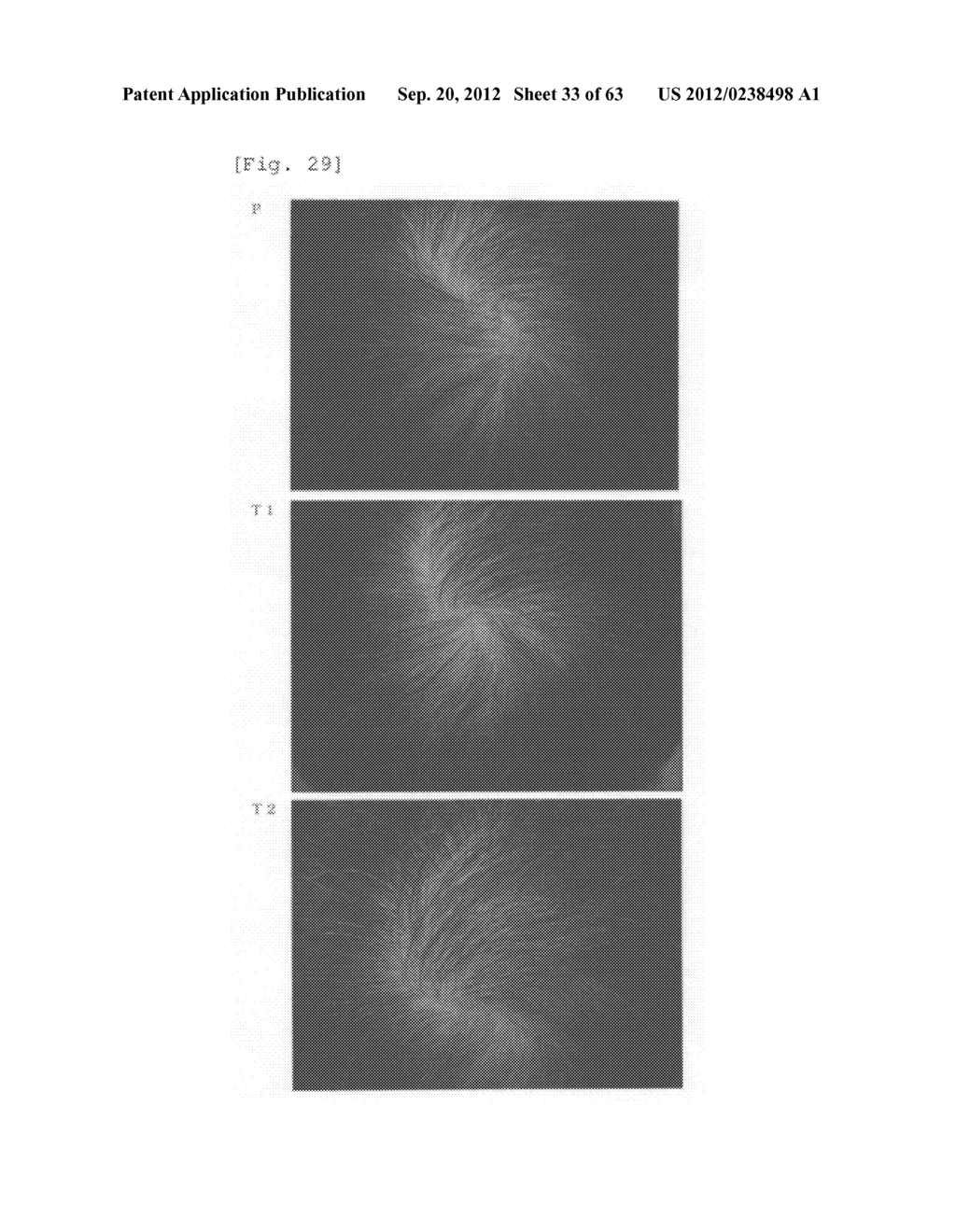 Agent for the treatment of alopecia - diagram, schematic, and image 34