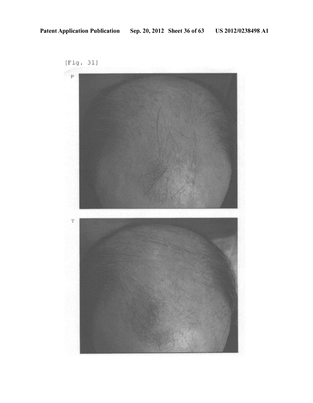 Agent for the treatment of alopecia - diagram, schematic, and image 37