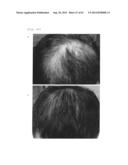 Agent for the treatment of alopecia diagram and image