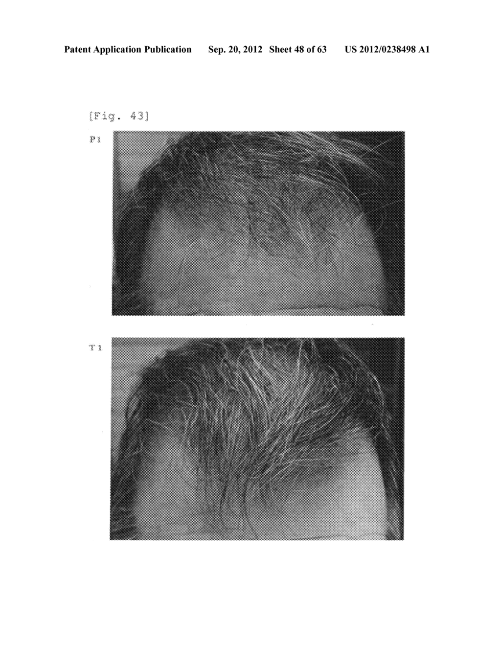 Agent for the treatment of alopecia - diagram, schematic, and image 49