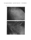 Agent for the treatment of alopecia diagram and image