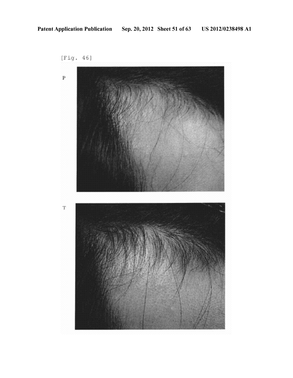 Agent for the treatment of alopecia - diagram, schematic, and image 52