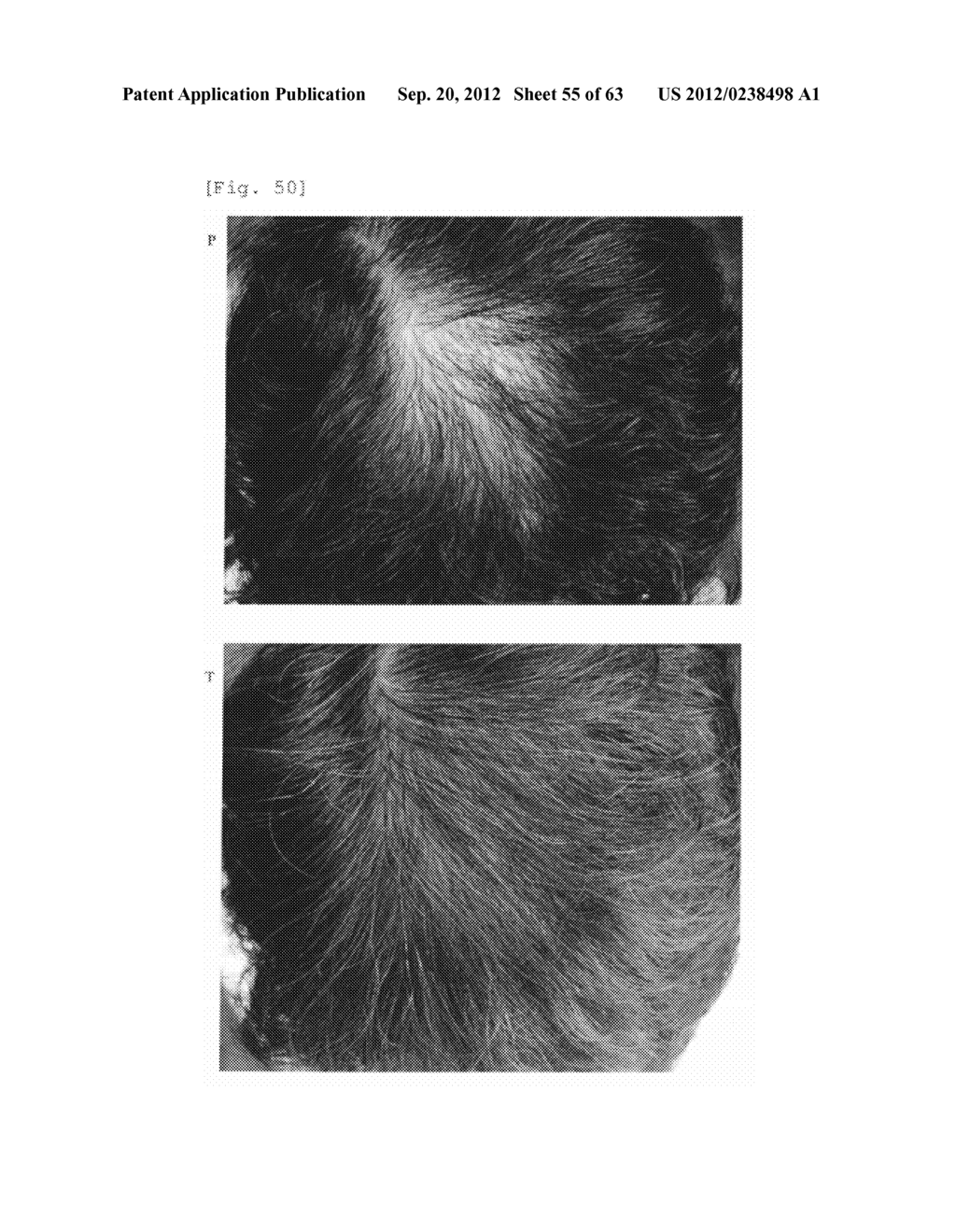 Agent for the treatment of alopecia - diagram, schematic, and image 56