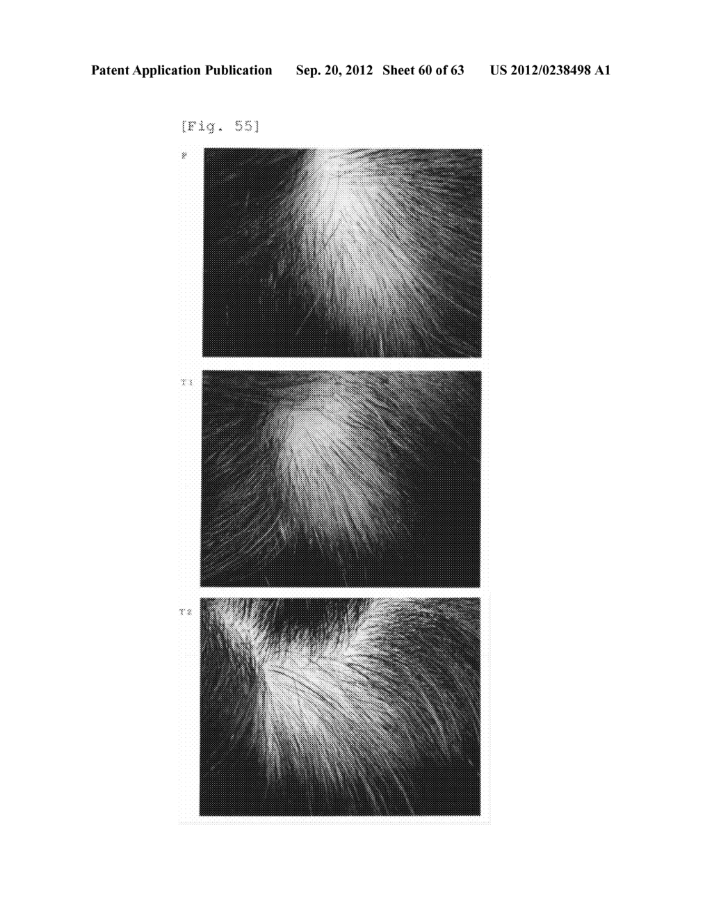 Agent for the treatment of alopecia - diagram, schematic, and image 61