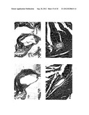 Use of phenylmethimazoles, methimazole derivatives, and tautomeric cyclic     thiones for the treatment of autoimmune/inflammatory diseases associated     with toll-like receptor overexpression diagram and image