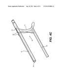 IMPLANTATION SYSTEM WITH HANDLE AND CATHETER AND METHOD OF USE THEREOF diagram and image