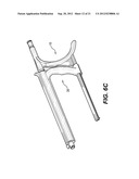 IMPLANTATION SYSTEM WITH HANDLE AND CATHETER AND METHOD OF USE THEREOF diagram and image