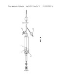 ENDOSCOPE diagram and image