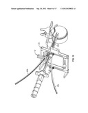 SURGICAL ACCESS SYSTEM AND RELATED METHODS diagram and image