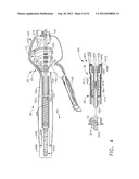 TRANS-RECTUM UNIVERSAL PORTS diagram and image