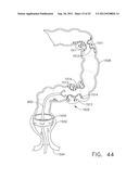 TRANS-RECTUM UNIVERSAL PORTS diagram and image