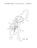 TRANS-RECTUM UNIVERSAL PORTS diagram and image