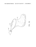 TRANS-RECTUM UNIVERSAL PORTS diagram and image