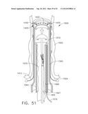 TRANS-RECTUM UNIVERSAL PORTS diagram and image