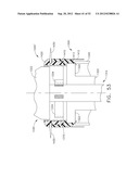 TRANS-RECTUM UNIVERSAL PORTS diagram and image