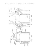 TRANS-RECTUM UNIVERSAL PORTS diagram and image