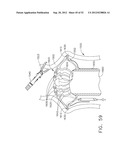 TRANS-RECTUM UNIVERSAL PORTS diagram and image