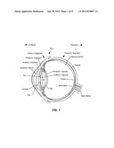 EXPANDABLE IMPLANTABLE PRESSURE SENSOR FOR INTRAOCULAR SURGERY diagram and image