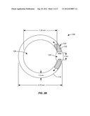 EXPANDABLE IMPLANTABLE PRESSURE SENSOR FOR INTRAOCULAR SURGERY diagram and image