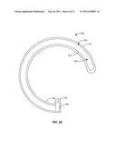 EXPANDABLE IMPLANTABLE PRESSURE SENSOR FOR INTRAOCULAR SURGERY diagram and image