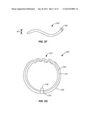 EXPANDABLE IMPLANTABLE PRESSURE SENSOR FOR INTRAOCULAR SURGERY diagram and image