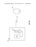 EXPANDABLE IMPLANTABLE PRESSURE SENSOR FOR INTRAOCULAR SURGERY diagram and image