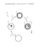 EXPANDABLE IMPLANTABLE PRESSURE SENSOR FOR INTRAOCULAR SURGERY diagram and image