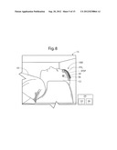 METHODS FOR USING MRI-COMPATIBLE PATCHES diagram and image