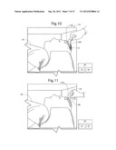 METHODS FOR USING MRI-COMPATIBLE PATCHES diagram and image