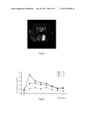 Method for Measuring the Physiological Parameters of Brain Interstitial     Fluid and Brain Extracellular Space diagram and image