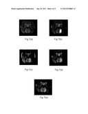 Method for Measuring the Physiological Parameters of Brain Interstitial     Fluid and Brain Extracellular Space diagram and image