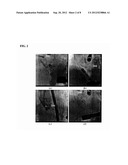 Method and System for Catheter Tracking in Fluoroscopic Images Using     Adaptive Discriminant Learning and Measurement Fusion diagram and image