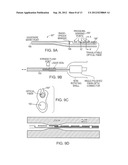 Intravascular Optical Coherence Tomography System with Pressure Monitoring     Interface and Accessories diagram and image