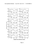 Intravascular Optical Coherence Tomography System with Pressure Monitoring     Interface and Accessories diagram and image