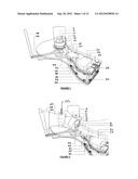 REHABILITATIVE APPARATUS FOR TREATING REFLEX SYMPATHETIC DYSTROPHY diagram and image