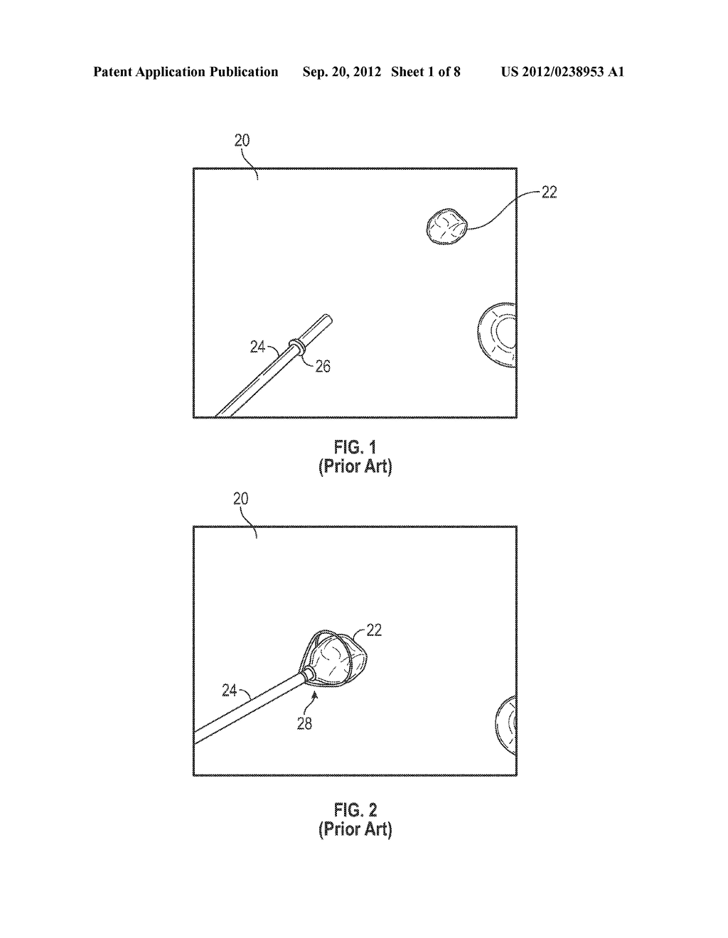 BIOPSY SPACER DEVICE AND METHOD OF OPERATION - diagram, schematic, and image 02