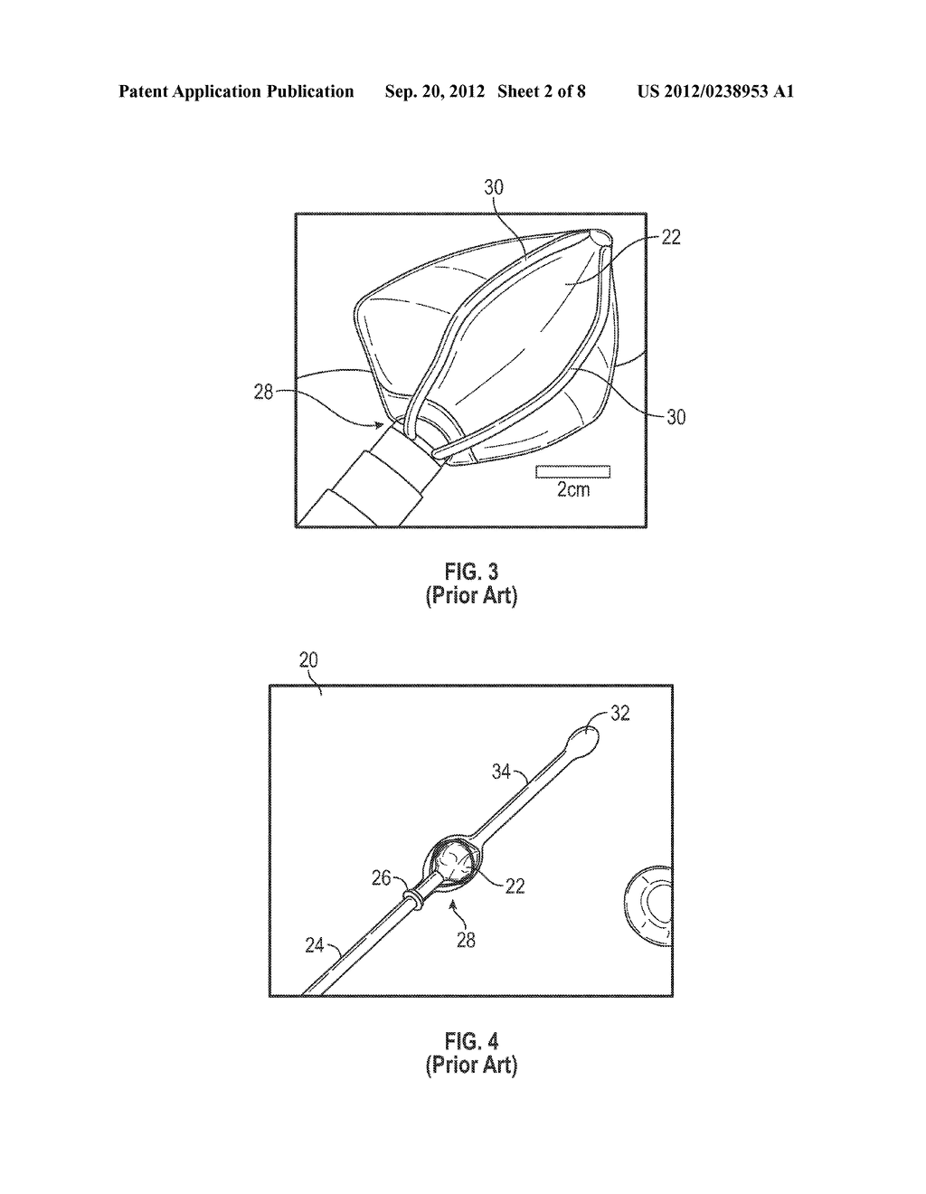 BIOPSY SPACER DEVICE AND METHOD OF OPERATION - diagram, schematic, and image 03