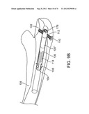 BONE FIXATION DEVICE, TOOLS AND METHODS diagram and image