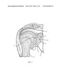 Combination Driver/Anti-Rotation Handle for Shoulder Arthroplasty diagram and image