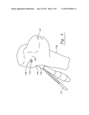 Drill guide for cruciate ligament repair diagram and image