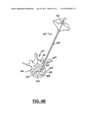 APPARATUS AND METHOD FOR STYLET-GUIDED VERTEBRAL AUGMENTATION diagram and image