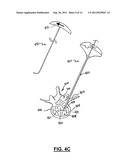 APPARATUS AND METHOD FOR STYLET-GUIDED VERTEBRAL AUGMENTATION diagram and image