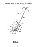 APPARATUS AND METHOD FOR STYLET-GUIDED VERTEBRAL AUGMENTATION diagram and image