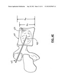 APPARATUS AND METHOD FOR STYLET-GUIDED VERTEBRAL AUGMENTATION diagram and image