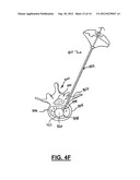 APPARATUS AND METHOD FOR STYLET-GUIDED VERTEBRAL AUGMENTATION diagram and image